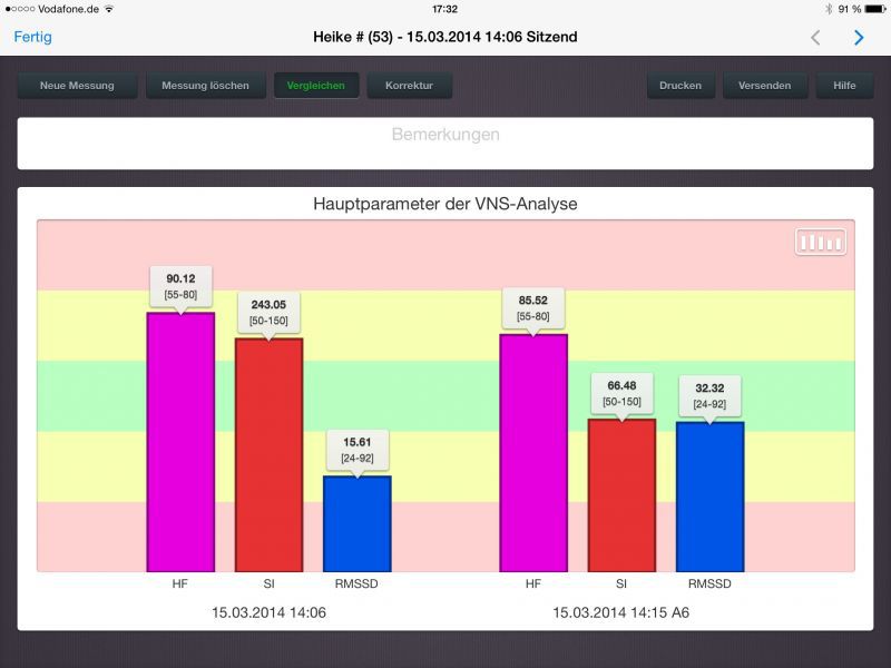 Grafisches Messprotokoll einer HRV Messung